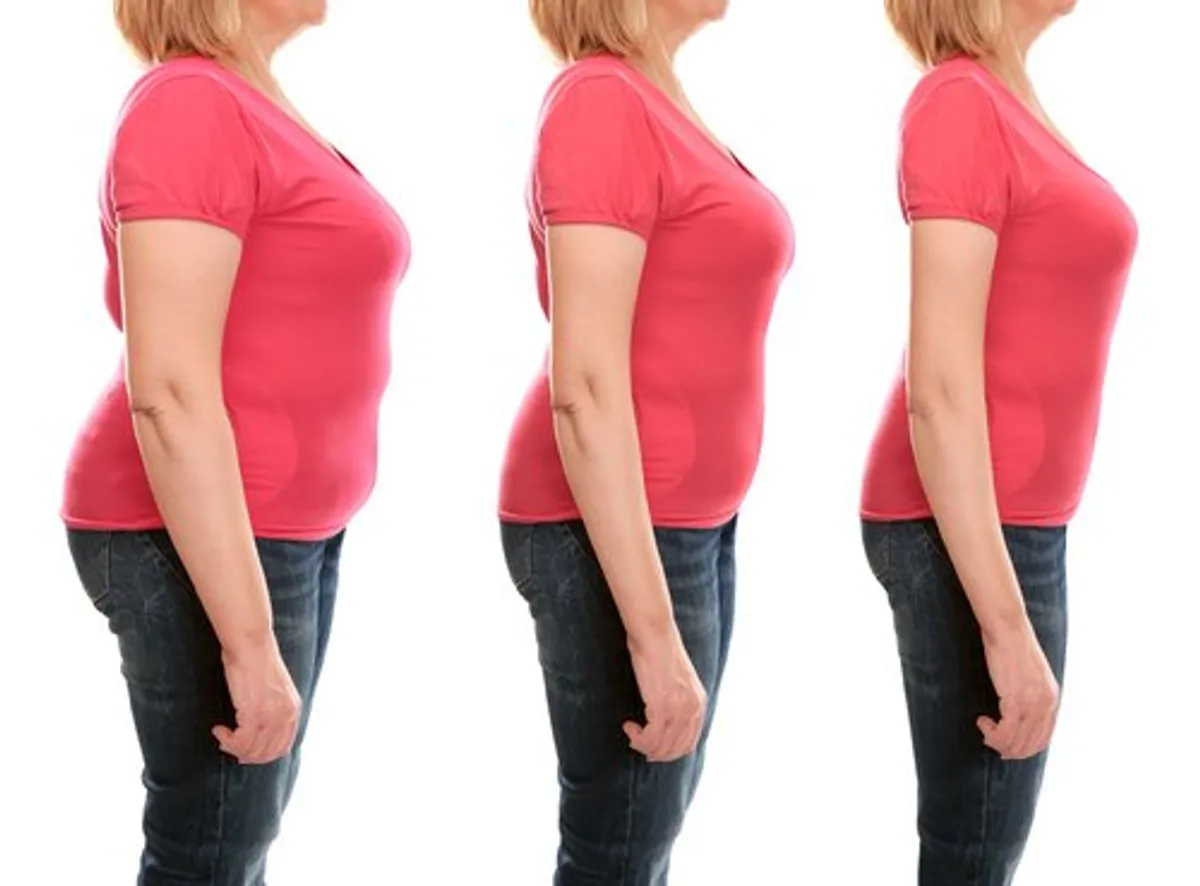 Une femme qui a perdu beaucoup de poids | Photo : Shutterstock